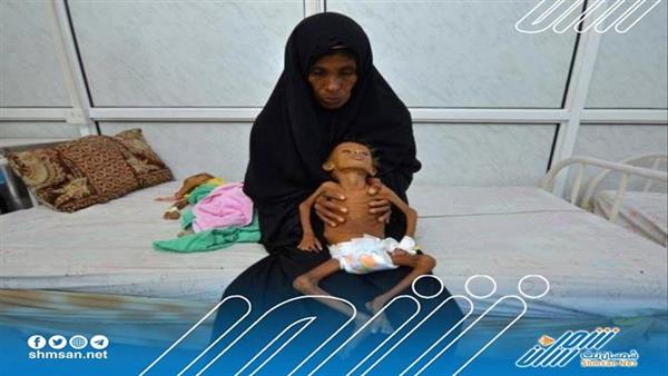 صحيفة البيان: جهود لطي صفحة الحرب في اليمن