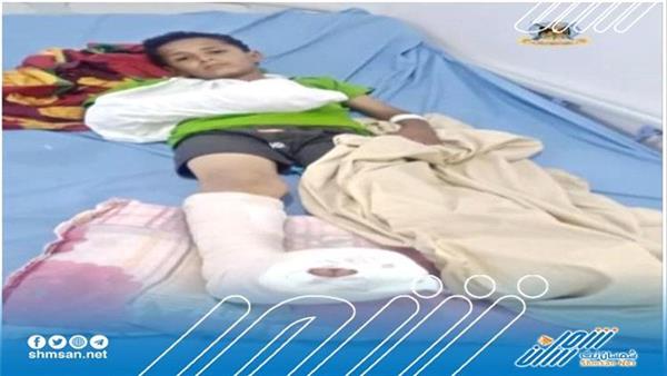 سقوط ضحايا من الاطفال بأنفجار مقذوف في منطقة حجر بالضالع 
