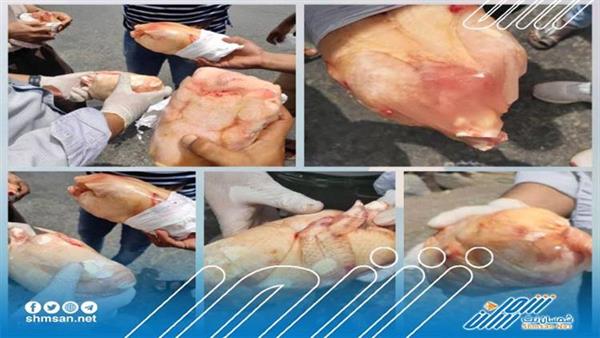 هيئة المواصفات والمقاييس تضبط وترفض حاوية دجاج فاسدة 