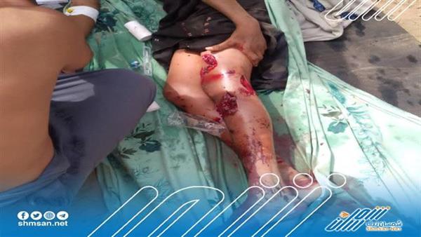 استشهاد مواطن واصابة آخر بقصف مليشيات الحوثي على قرية هيجة العبد في حيس