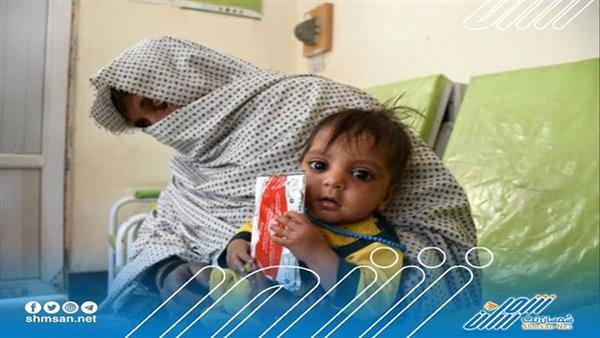 منظمة اليونيسف: نعمل على وصول الأطفال لأنظمة غذائية آمنة
