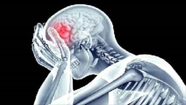 نصائح لتجنب الإصابة بالجلطة الدماغية ! 