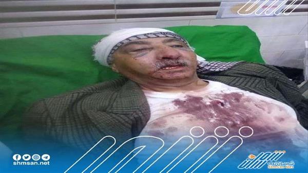ميليشيات الحوثي تقتحم منزل شيخ بارز وتنهال عليه بالضرب المبرح في صنعاء